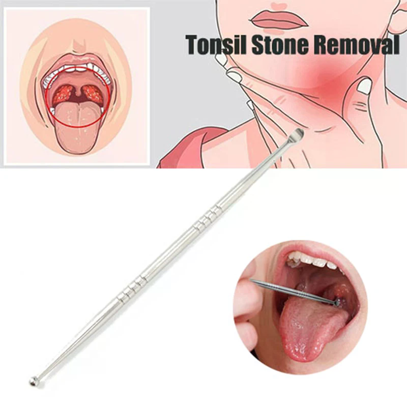 1pc Remover Tool Stainless Ton - Ear Wax Remover review and price